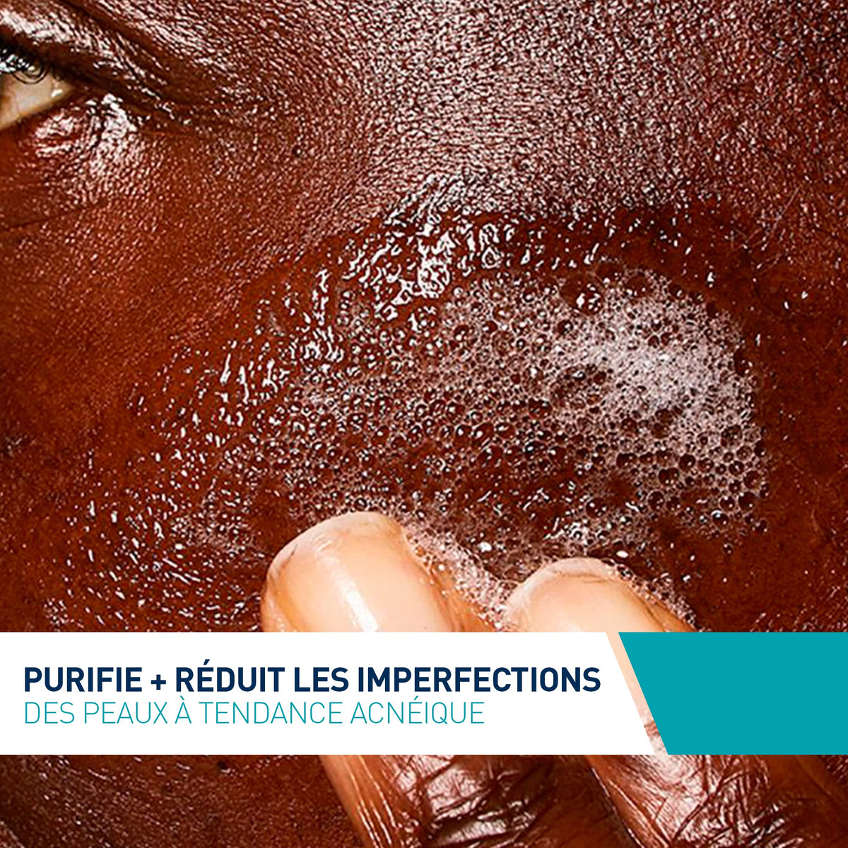 CeraVe - Gel Moussant Anti-Imperfections - Purifie la Peau en douceur et Réduit les Imperfections - Acide Salicylique, Argile Blanche, Céramides et Niacinamide - Peau à Tendance Acnéique